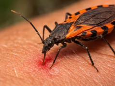 Día Mundial de la Enfermedad de Chagas, una enfermedad endémica de Salta La Enfermedad de Chagas, una dolencia trasmitida por el parásito Trypanosoma cruzi. También se le llama tripanosoomiasis americana
