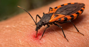 La Enfermedad de Chagas, una dolencia trasmitida por el parásito Trypanosoma cruzi. También se le llama tripanosoomiasis americana